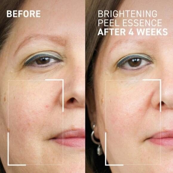 DR. BRANDT dr b labs BRIGHTENING PEEL ESSENCE - Picture 2 of 6